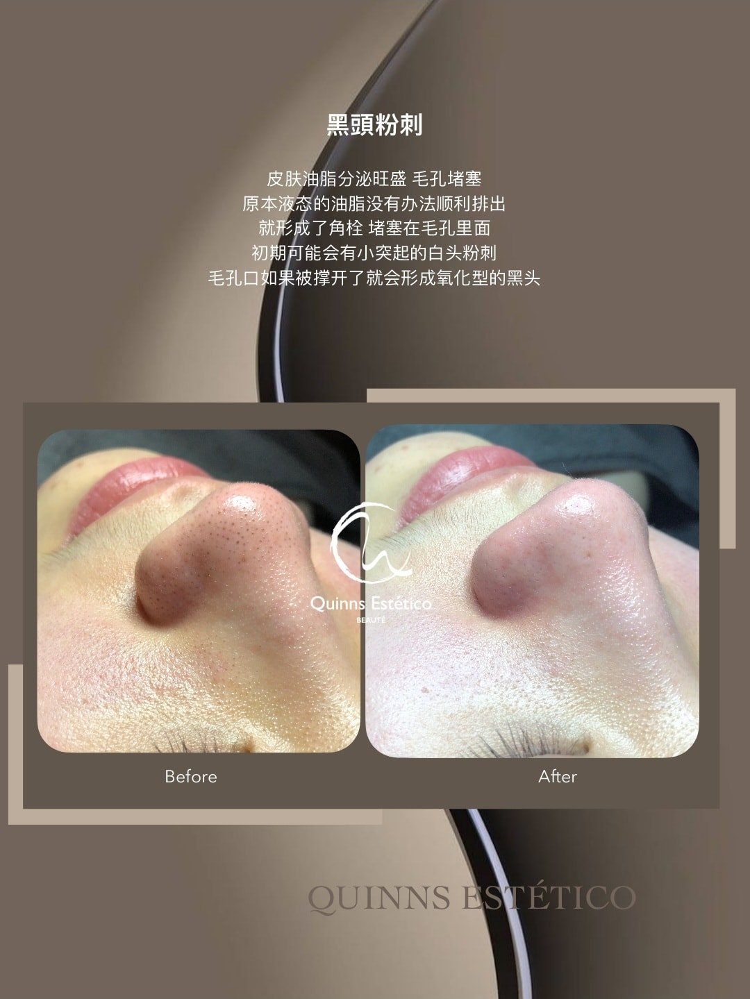 jb美容院